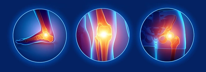 Digital illustration highlighting pain points in the ankle, knee, and hip joints, represented with glowing effects.